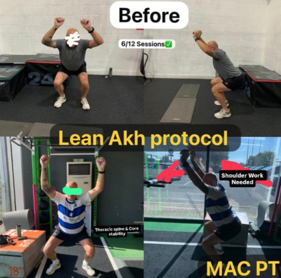 Lean Akh Protocol before & after โ form reset